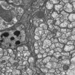 Glial cell in central brain. Dom Vita.