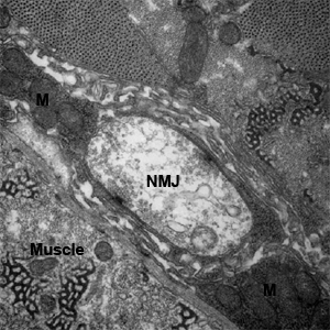 EM of Fly Neuromuscular Junction (NMJ)