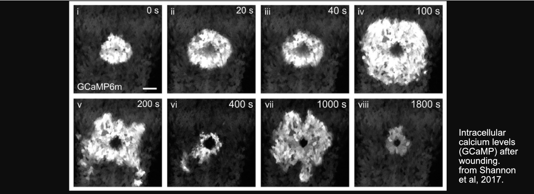 Vanderbilt University