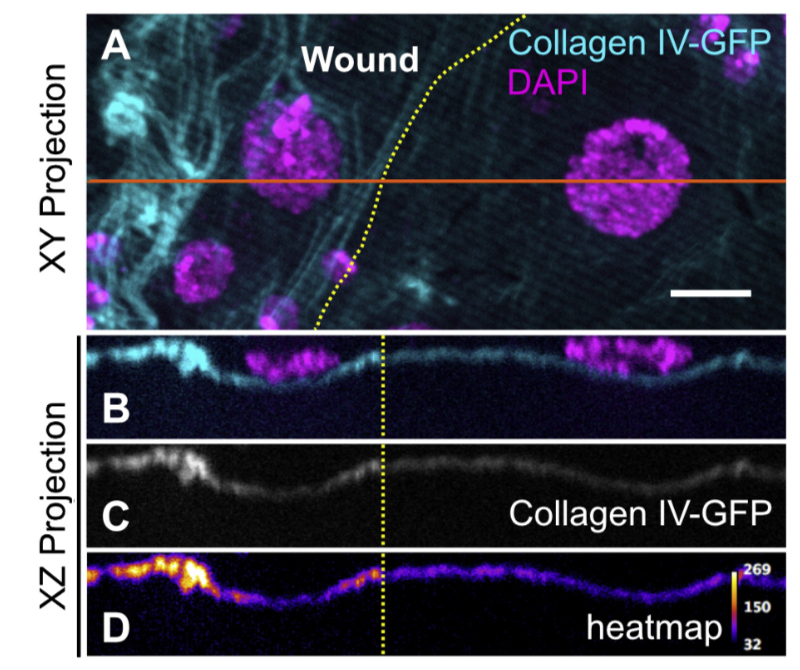 Vanderbilt University