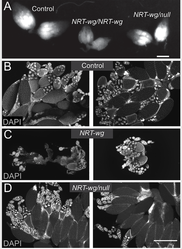 Vanderbilt University